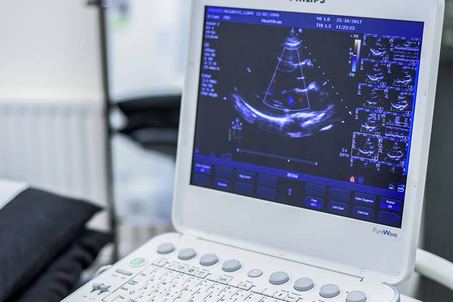 A echo scan of the patients heart is being displayed on the screen